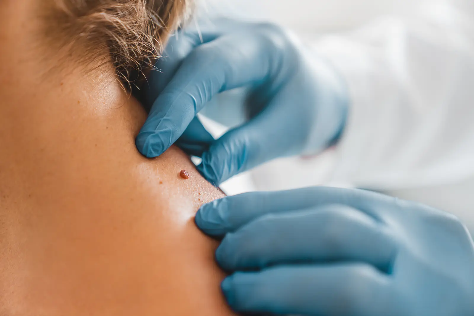 dermatolog-stargard dermatolog-stargard